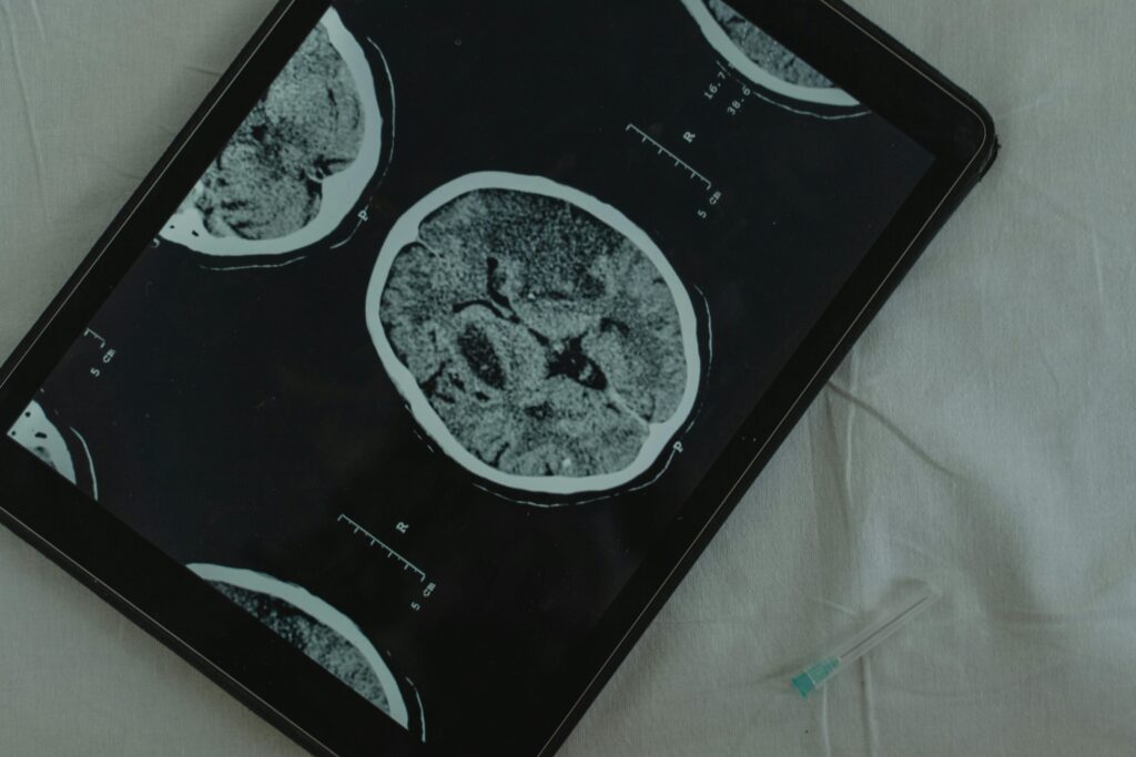 Tablet screen displaying detailed brain scan images, placed on a clinical white background.